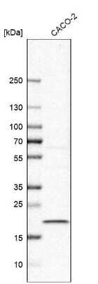 Western Blot: TMEM199 Antibody [NBP1-88467]