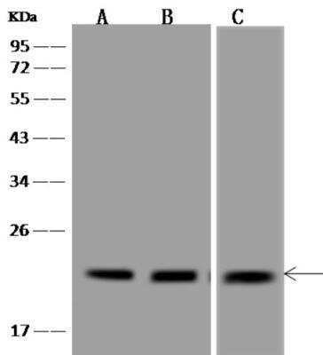 Western Blot: TMEM199 Antibody [NBP3-06494]