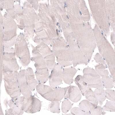 Immunohistochemistry-Paraffin: TMEM2 Antibody [NBP1-94168]