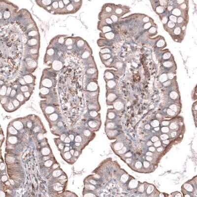 Immunohistochemistry-Paraffin: TMEM2 Antibody [NBP1-94168]