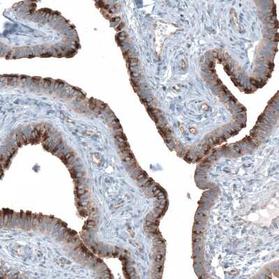 Immunohistochemistry-Paraffin: TMEM2 Antibody [NBP1-94168]