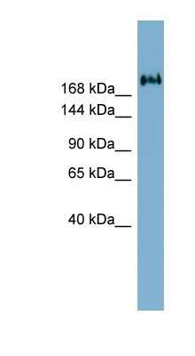 Western Blot: TMEM2 Antibody [NBP1-91561]