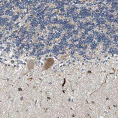 Immunohistochemistry-Paraffin: TMEM200A Antibody [NBP1-81362]