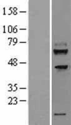 Western Blot: TMEM200A Overexpression Lysate [NBL1-17056]