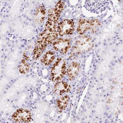 Immunohistochemistry-Paraffin: TMEM200B Antibody [NBP2-49178]