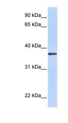 Western Blot: TMEM200B Antibody [NBP1-91575]