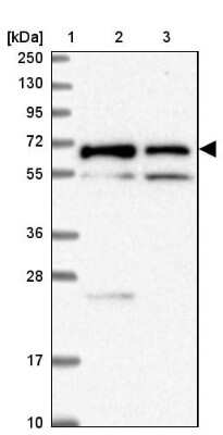 Western Blot: TMEM200C Antibody [NBP2-30838]