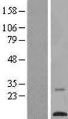 Western Blot: TMEM203 Overexpression Lysate [NBL1-17058]