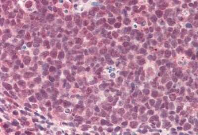 Immunohistochemistry-Paraffin: TMEM205 Antibody [NBP1-52109]