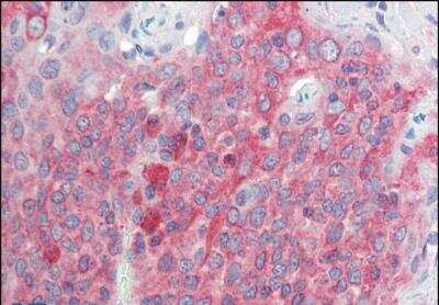 Immunohistochemistry-Paraffin: TMEM205 Antibody [NBP1-52110]