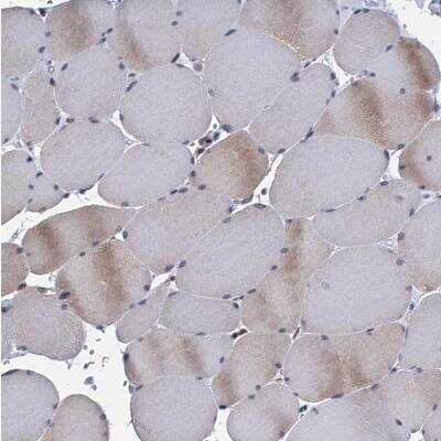 Immunohistochemistry-Paraffin: TMEM205 Antibody [NBP1-81255]