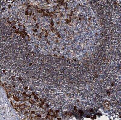 Immunohistochemistry-Paraffin: TMEM205 Antibody [NBP1-81255]
