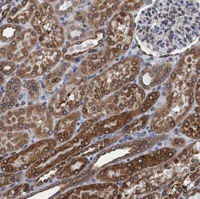 Immunohistochemistry-Paraffin: TMEM205 Antibody [NBP1-81255]