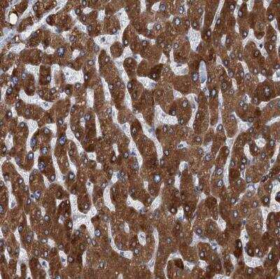 Immunohistochemistry-Paraffin: TMEM205 Antibody [NBP1-81255]