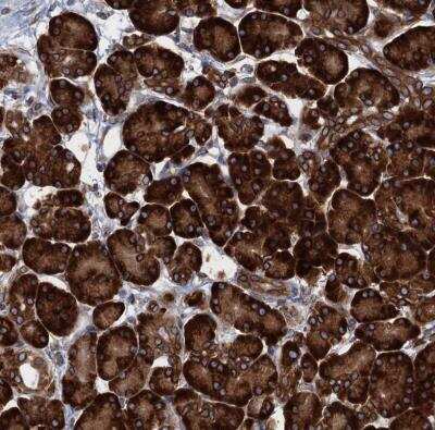Immunohistochemistry-Paraffin: TMEM205 Antibody [NBP1-81255]