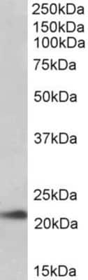 Western Blot: TMEM205 Antibody [NBP1-52109]