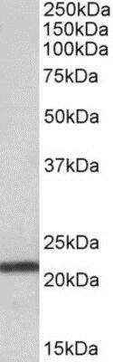 Western Blot: TMEM205 Antibody [NBP1-52110]