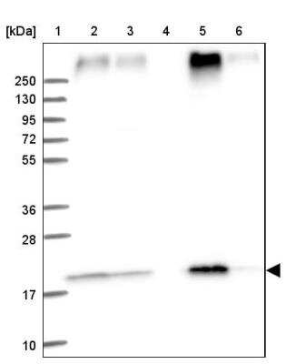 Western Blot: TMEM205 Antibody [NBP1-81255]