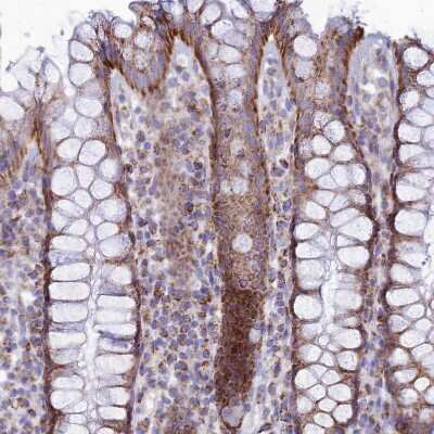 Immunohistochemistry-Paraffin: TMEM206 Antibody [NBP1-88325]