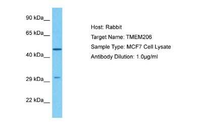 Western Blot: TMEM206 Antibody [NBP2-85944]