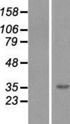 Western Blot: TMEM206 Overexpression Lysate [NBP2-06837]