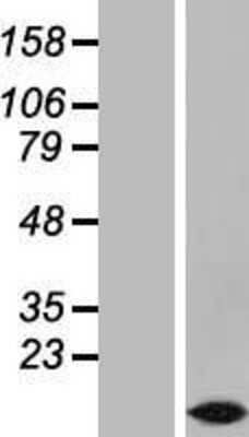 Western Blot: TMEM207 Overexpression Lysate [NBL1-17062]