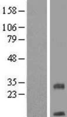 Western Blot: TMEM208 Overexpression Lysate [NBL1-17063]