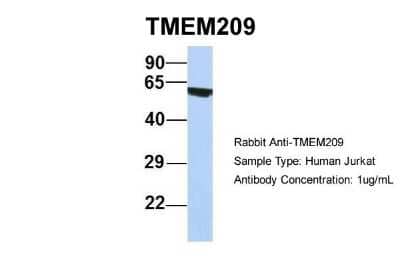 Western Blot: TMEM209 Antibody [NBP1-91493]