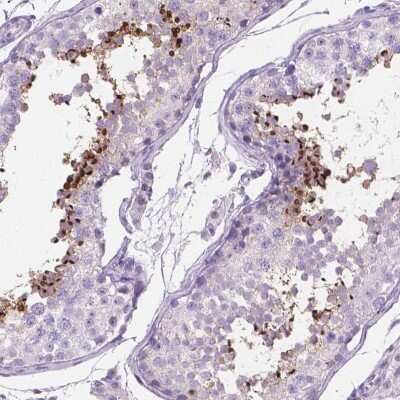 Immunohistochemistry-Paraffin: TMEM210 Antibody [NBP2-49498]