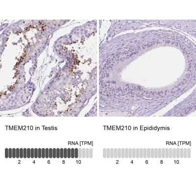 Immunohistochemistry-Paraffin: TMEM210 Antibody [NBP2-49498]