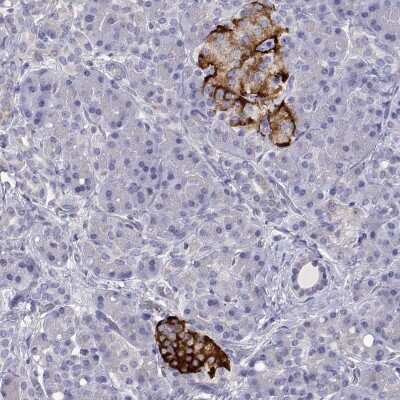 Immunohistochemistry-Paraffin: TMEM211 Antibody [NBP2-38095]