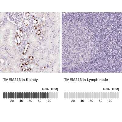 Immunohistochemistry-Paraffin: TMEM213 Antibody [NBP2-30616]