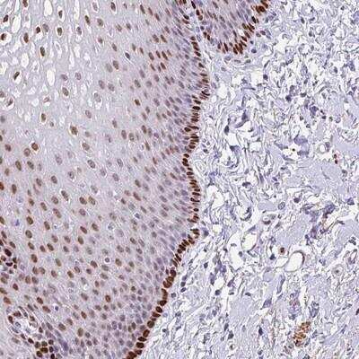 Immunohistochemistry-Paraffin: TMEM215 Antibody [NBP2-14772]