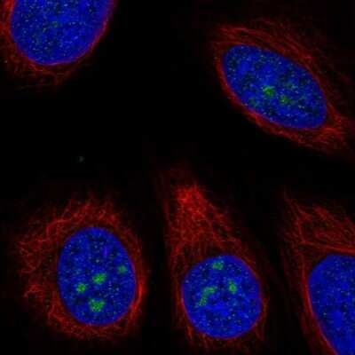 Immunocytochemistry/ Immunofluorescence: TMEM217 Antibody [NBP2-68661]