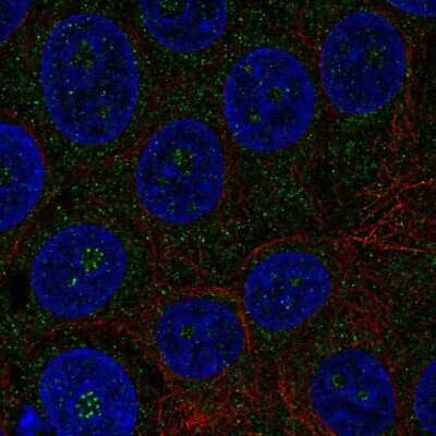 Immunocytochemistry/ Immunofluorescence: TMEM217 Antibody [NBP2-68982]