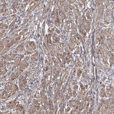 Immunohistochemistry-Paraffin: TMEM218 Antibody [NBP1-90988]