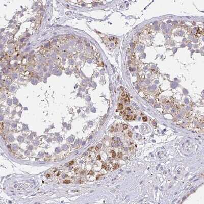 Immunohistochemistry-Paraffin: TMEM219 Antibody [NBP2-32439]