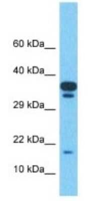 Western Blot: TMEM220 Antibody [NBP3-10581]