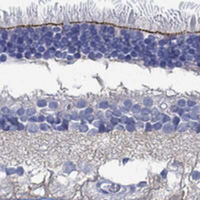 Immunohistochemistry-Paraffin: TMEM221 Antibody [NBP3-17551]