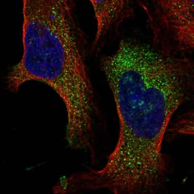 Immunocytochemistry/ Immunofluorescence: TMEM222 Antibody [NBP2-49295]