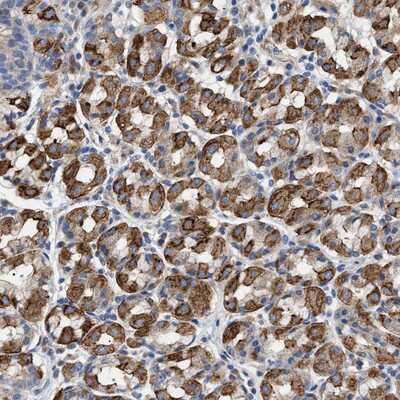 Immunohistochemistry-Paraffin: TMEM222 Antibody [NBP2-13449]