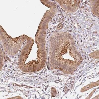 Immunohistochemistry-Paraffin: TMEM222 Antibody [NBP2-49295]