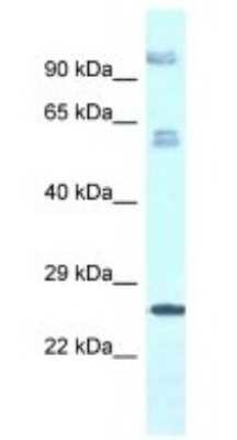 Western Blot: TMEM222 Antibody [NBP1-79831]