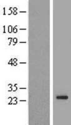 Western Blot: TMEM222 Overexpression Lysate [NBL1-17067]