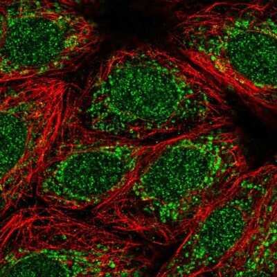 Immunocytochemistry/ Immunofluorescence: TMEM223 Antibody [NBP1-93492]