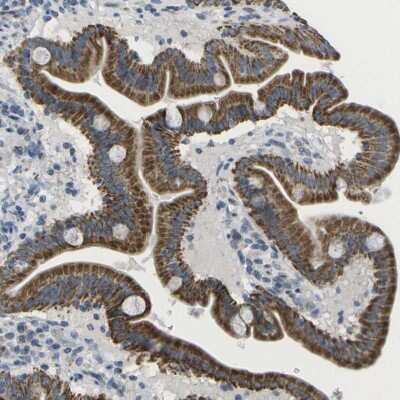 Immunohistochemistry-Paraffin: TMEM223 Antibody [NBP1-93492]