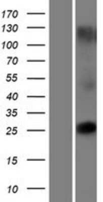 Western Blot: TMEM225 Overexpression Lysate [NBP2-08730]