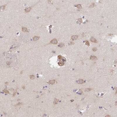 Immunohistochemistry-Paraffin: TMEM229A Antibody [NBP2-33783]