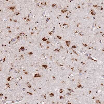 Immunohistochemistry-Paraffin: TMEM229B Antibody [NBP1-92520]