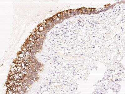 Immunohistochemistry-Paraffin: TMEM231 Antibody [NBP3-06280]